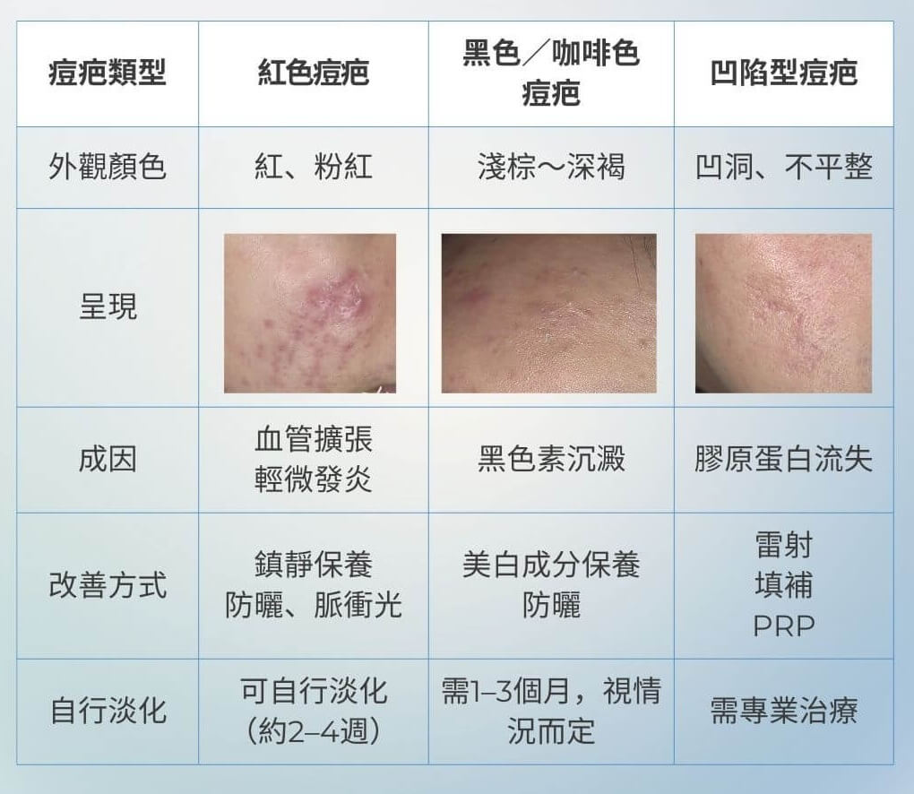 痘疤種類比較表2 (1)